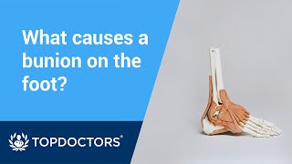 What causes bunions?