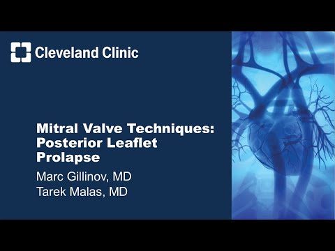 Mitral Valve Techniques: Posterior Leaflet Prolapse (Graphic)