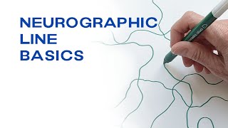 Tips on How to Draw Neurographic Lines with Ease