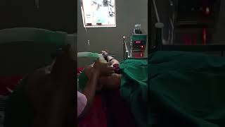 OVUM PICK UP    #shorts #viral #shortvideo