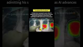 Dubai Doctor Fears Job Loss After AI Diagnoses X-ray in Seconds