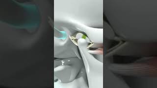 Is the #ringing  In my ears #tinnitus  or #tmj ?