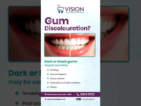 Is gum discolouration holding back your smile?