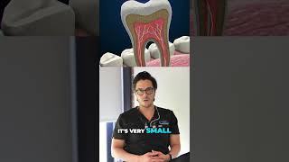How to Reverse Tooth Decay 🦷