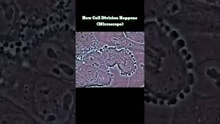 How Cell Division Happens (Microscope)                  #cell #celldivision #interesting #dna #human