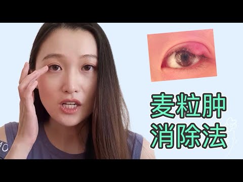 得了麦粒肿怎么办？治疗方法，如何预防日后复发 【D视界】#麥粒腫#热敷疗法