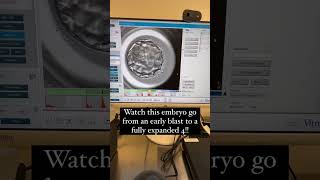 Gorgeous Embryo #1: Witness the Beauty of IVF Development!