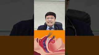 "Beat Sleep Apnea Now! (See How Inside)"