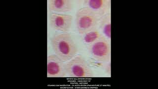Mitosis - Cell Division different stages under Microscope #biology #neet #agriculture #genetics