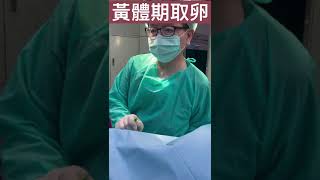 黃體期取卵手術