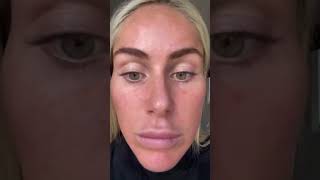 Result ZENA Peeling Algae  - Step by Step#zenabeauty #zenacosmetics #zenaalgaepeeling #zenapeeling