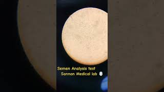 Semen Analysis 🧐 #youtubeshorts #medicallab #humanbodysystem #biology #medicallaboratory