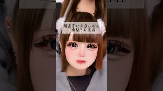 [Double eyelid surgery] #shorts A close look at the double eyelid surgery of a landmine girl