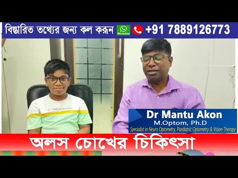 Lazy Eye Treatment।অলস চোখের চিকিৎসা। Amblyopia চিকিৎসা।आलसी नेत्र उपचार।Dr Mantu Akon।