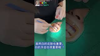 在韩国牙科做牙齿美白整形#shorts