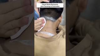 Fair Neck Remedy/Clean Neck Dirt & Suntan Immediately #neck #dark #suntanned #recipe #remedy #shorts
