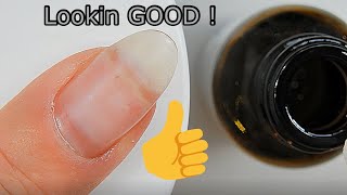 FINAL UPDATE on LIFTED NAIL