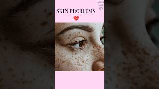 Skin problems vocabulary.#english#spokenenglish#esltips#englishvocabulary#learnenglish#dailyenglish