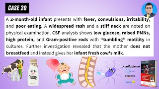 Case based Medical Microbiology Tutorials: Case 20: Seizure in infant after fresh cow-milk ingestion