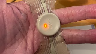 Reviewing and taking off the Zio heart monitor ￼