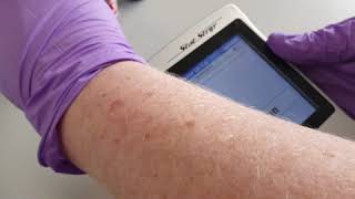 Performing glucose Quality Control (QC) on the NOVA StatStrip meter