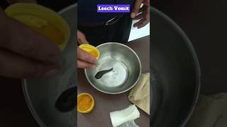 How to make a Leech Vomit after Jalaukavacharanam🥼😨#shorts #ytshorts #bamslife #neet #ayurveda