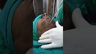 Double Chin | Double Chin video | Double Chin Surgery | Double Chin cost