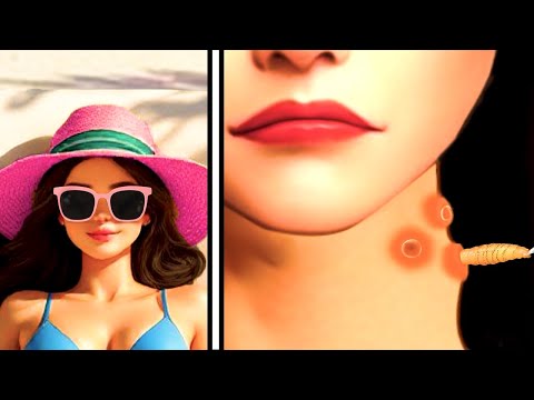 ASMR Removal of Botfly Worms Crawling Under The Skin😱| Funny Animation