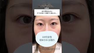 指1本でクマ取りシミュレーション#美容 #美容整形 #垢抜け #若返り