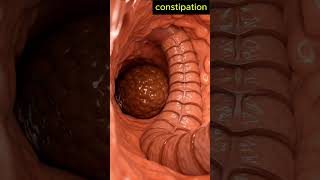 Slow Motion Constipated Stool Exit – Human Anatomy | 136