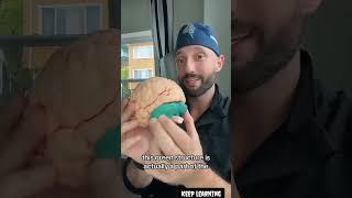 Brain anatomy by Dr z neurosurgery.