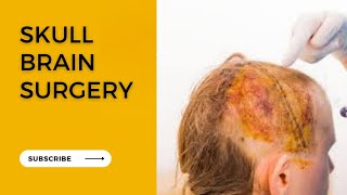 ASMR Brain surgery animation - Skull base surgery - Penn medicine - Brain injury