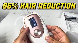 Oreeth IPL is ALREADY REPLACING Salon Laser Treatments