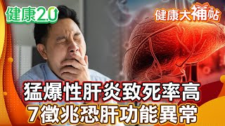 猛爆性肝炎致死率高！ 7大徵兆恐肝功能異常！3要3不要飲食護肝臟！【#健康大補帖】健康2.0 #鄭凱云 #陳欣湄  #韋汝