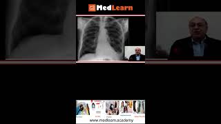 Medlearn (Quick note)