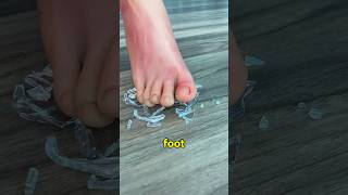 What to Do Immediately If You Step on Glass‼️😱