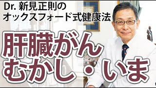 肝臓がん　むかし・いま【Dr.新見正則のオックスフォード式健康法】
