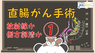 【直腸がんですと言われたら（放射線か側方郭清か！）】