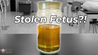 Why Someone Tried to Take Our Lab’s Fetus!