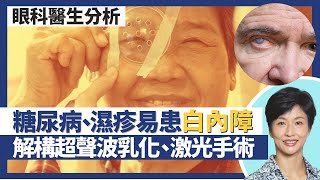 白內障｜糖尿病、濕疹病人易患白內障？眼科醫生解構超聲波乳化手術、激光白內障手術 手術無需等熟透？怕光、近視遠視急速加深都是白內障先兆｜王建芳醫生 眼科醫生袁尚清醫生｜人類健康研究所