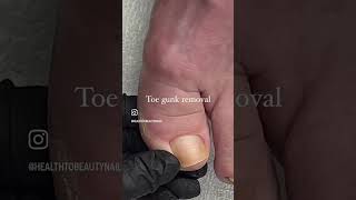 Toe gunk removal *satisfying* #deadskin #pedicure #satisfyingvideo #toenails #cleannails