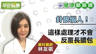 針眼惱人！眼科醫師：這樣處理才不會反覆長膿包【眼科醫師 林友祺／健康顧眼睛】