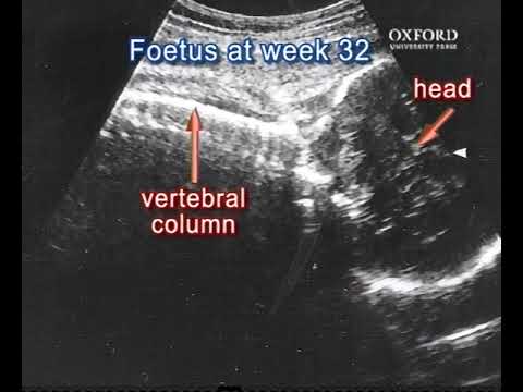 Video 13.1 Examination of different stages of foetal development