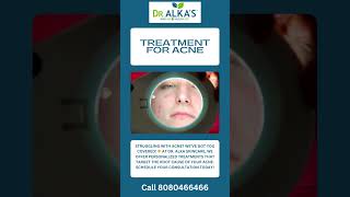 Treatment for Acne