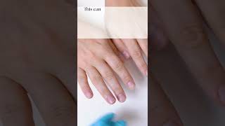 Nail Care Mastery: Safe Form Handling & Essential Practices for Gorgeous Nails!