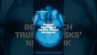 China brain tech rivals Musk’s Neuralink