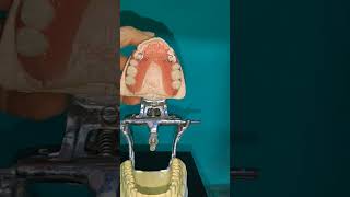 Prótesis Dental flexible Partial Flex