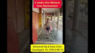 Patient walking strong 2 weeks after Bilateral Knee Replacement- Revolutionizing Patient Recovery