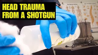 Deceased trauma shotgun Vs handgun