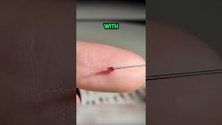 This is INSANE! Berry Surgery! 🤯